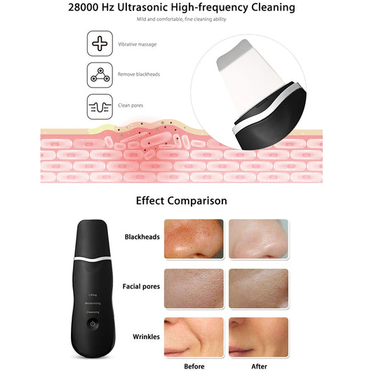 Ultrasonic Skin Scrubber
